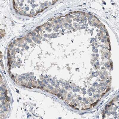 Immunohistochemistry-Paraffin: BNC2 Antibody [NBP1-88501]