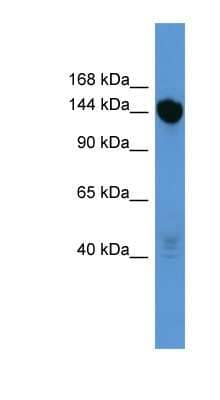 Western Blot: BNC2 Antibody [NBP1-69078]