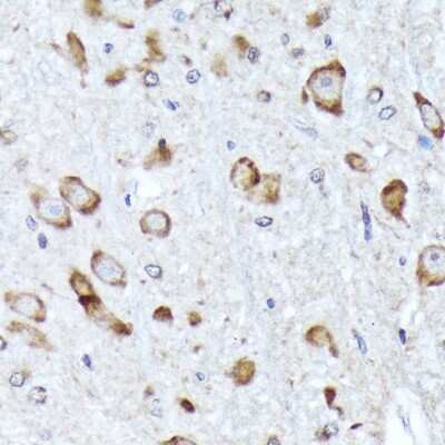 Immunohistochemistry-Paraffin: BNIP1 Antibody (10K6T9) [NBP3-16403]