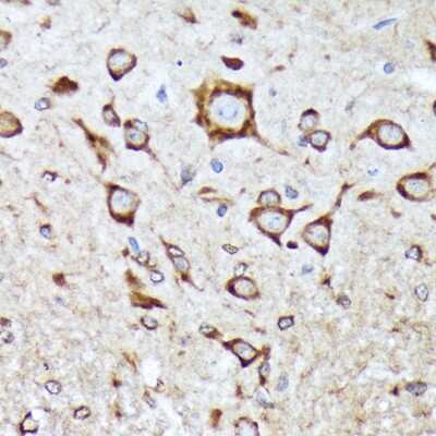 Immunohistochemistry-Paraffin: BNIP1 Antibody (10K6T9) [NBP3-16403]