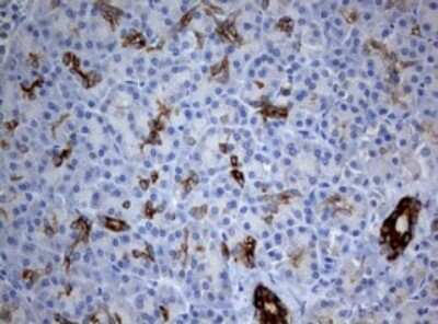 Immunohistochemistry: BNIP1 Antibody (OTI2B3) [NBP2-46580]