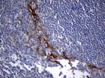 Immunohistochemistry: BNIP1 Antibody (OTI2B3) [NBP2-46580]