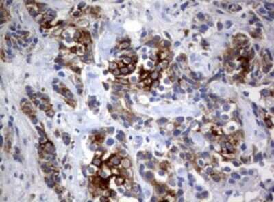 Immunohistochemistry: BNIP1 Antibody (OTI2B3) [NBP2-46580]
