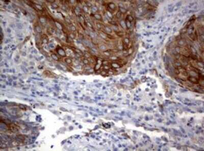 Immunohistochemistry: BNIP1 Antibody (OTI2B3) [NBP2-46580]