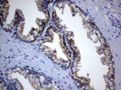 Immunohistochemistry: BNIP1 Antibody (OTI2B3) [NBP2-46580]