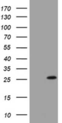 Western Blot: BNIP1 Antibody (OTI2B3) [NBP2-46580]