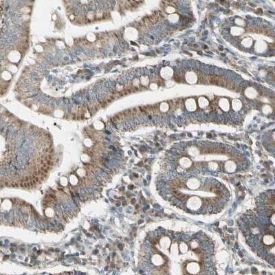 Immunohistochemistry-Paraffin: BNIP1 Antibody [NBP1-82567]