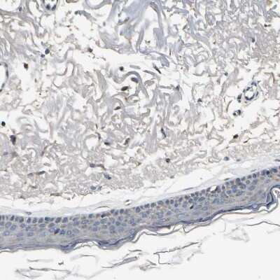 Immunohistochemistry-Paraffin: BNIP1 Antibody [NBP1-82567]