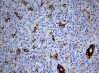 Immunohistochemistry: BNIP1 Antibody (OTI2B3) - Azide and BSA Free [NBP2-70257]