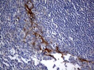 Immunohistochemistry: BNIP1 Antibody (OTI2B3) - Azide and BSA Free [NBP2-70257]