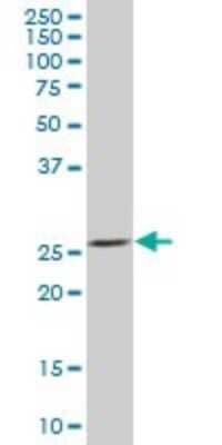 Western Blot: BNIP1 Antibody [H00000662-B01P]