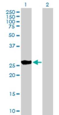 Western Blot: BNIP1 Antibody [H00000662-B01P]