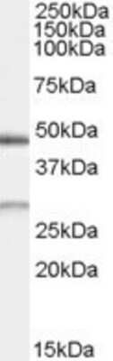 Western Blot: BNIP1 Antibody [NB100-68161]