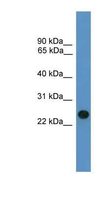 Western Blot: BNIP1 Antibody [NBP1-69183]