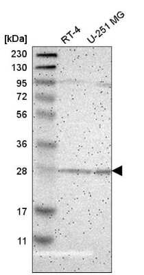 Western Blot: BNIP1 Antibody [NBP2-58913]