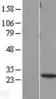 Western Blot: BNIP1 Overexpression Lysate [NBL1-08012]