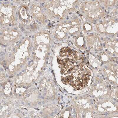 Immunohistochemistry-Paraffin: BNIP2 Antibody [NBP1-88559]