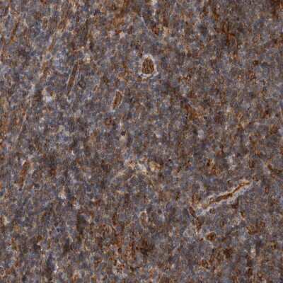 Immunohistochemistry-Paraffin: BNIP2 Antibody [NBP1-88559]