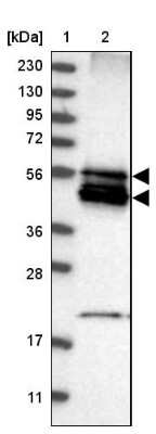 Western Blot: BNIP2 Antibody [NBP1-88559]