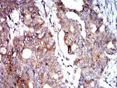 Immunohistochemistry-Paraffin: BNIP3 Antibody (6A5F7) - BSA Free [NBP2-61715]
