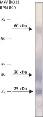 Western Blot: BNIP3 Antibody (ANa40)BSA Free [NB100-1543]