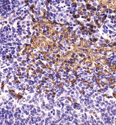 Immunohistochemistry: BNIP3 Antibody - BSA Free [NBP1-77683]