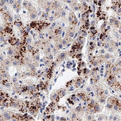 Immunohistochemistry-Paraffin: BNIP3 Antibody [NB100-56150]