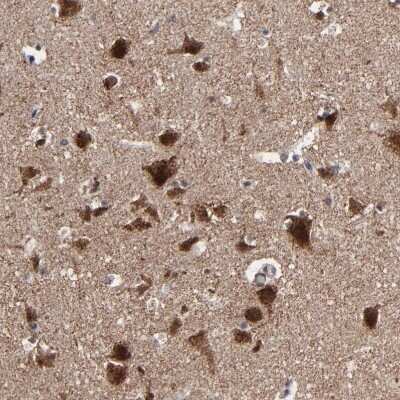 Immunohistochemistry-Paraffin: BNIP3 Antibody [NBP1-82566]