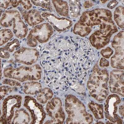Immunohistochemistry-Paraffin: BNIP3 Antibody [NBP1-82566]