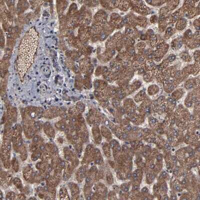 Immunohistochemistry-Paraffin: BNIP3 Antibody [NBP1-82566]