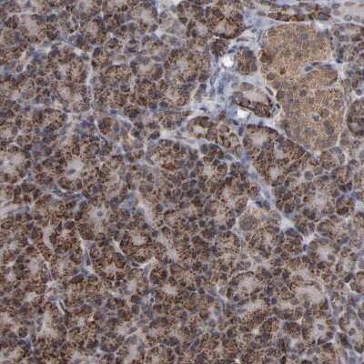 Immunohistochemistry-Paraffin: BNIP3 Antibody [NBP1-82566]
