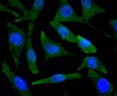 Immunocytochemistry/ Immunofluorescence: BNIP3 Antibody (JA71-10) [NBP2-67192]