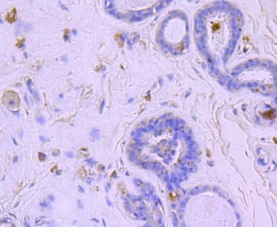 Immunohistochemistry-Paraffin: BNIP3 Antibody (JA71-10) [NBP2-67192]