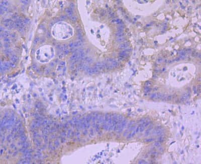 Immunohistochemistry-Paraffin: BNIP3 Antibody (JA71-10) [NBP2-67192]