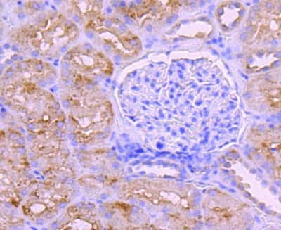 Immunohistochemistry-Paraffin: BNIP3 Antibody (JA71-10) [NBP2-67192]