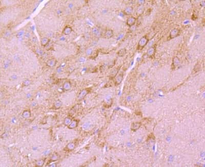 Immunohistochemistry-Paraffin: BNIP3 Antibody (JA71-10) [NBP2-67192]