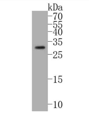 Western Blot: BNIP3 Antibody (JA71-10) [NBP2-67192]