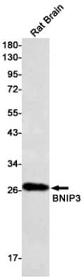 Western Blot: BNIP3 Antibody (S09-1G8) [NBP3-19550]