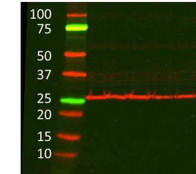 Western Blot: BNIP3 Antibody [NB100-56150]