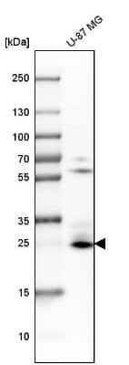 Western Blot: BNIP3 Antibody [NBP1-82566]