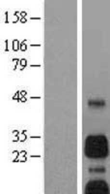 Western Blot: BNIP3 Overexpression Lysate [NBL1-08014]