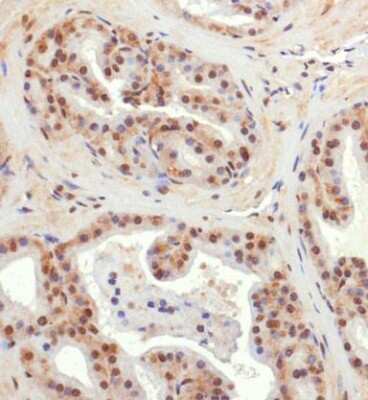Immunohistochemistry: BNIP3L Antibody - BSA Free [NBP1-78264]