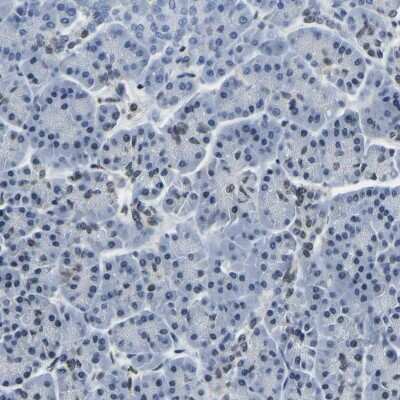 Immunohistochemistry-Paraffin: BNIP3L Antibody [NBP1-88558]