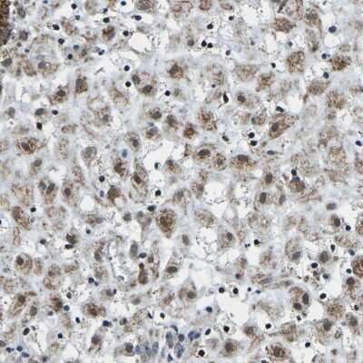 Immunohistochemistry-Paraffin: BNIP3L Antibody [NBP1-88558]