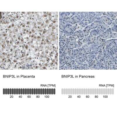 Immunohistochemistry-Paraffin: BNIP3L Antibody [NBP1-88558]