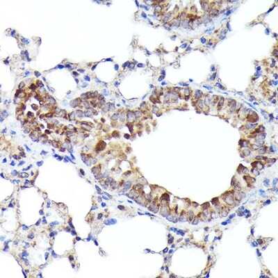 Immunohistochemistry-Paraffin: BNIP3L Antibody - Azide and BSA Free [NBP2-92792]
