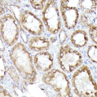 Immunohistochemistry-Paraffin: BNIP3L Antibody - Azide and BSA Free [NBP2-92792]