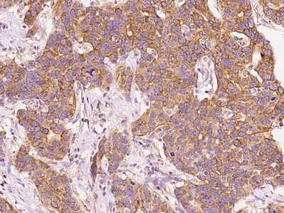 Immunohistochemistry-Paraffin: BNIP3L Antibody [NBP3-00002]