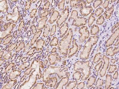 Immunohistochemistry-Paraffin: BNIP3L Antibody [NBP3-00002]