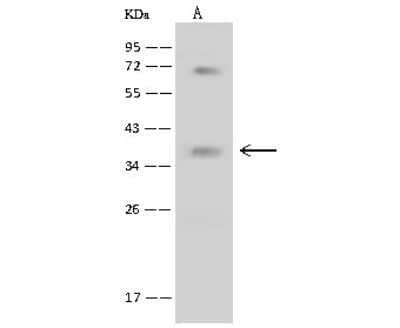 Western Blot: BNIP3L Antibody [NBP3-00002]